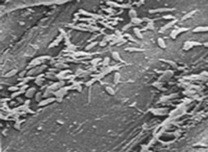 microscopic bacteria succession in milk